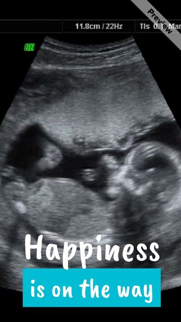 On the Way #2 Video Template