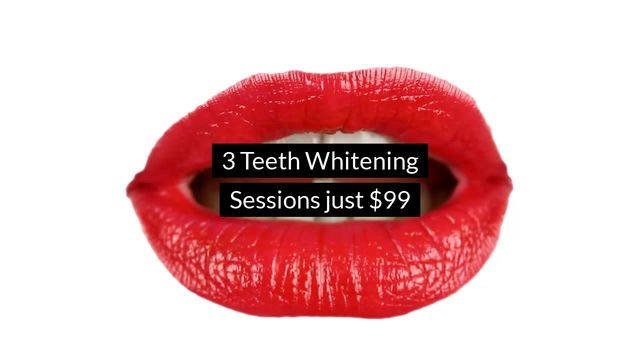 Teeth Whitening Video Template
