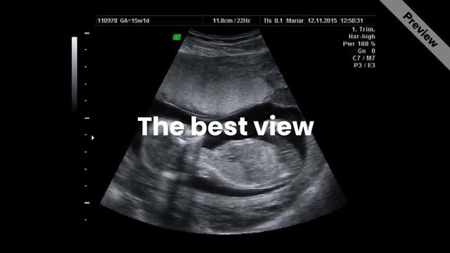 Build Your Family Video Template